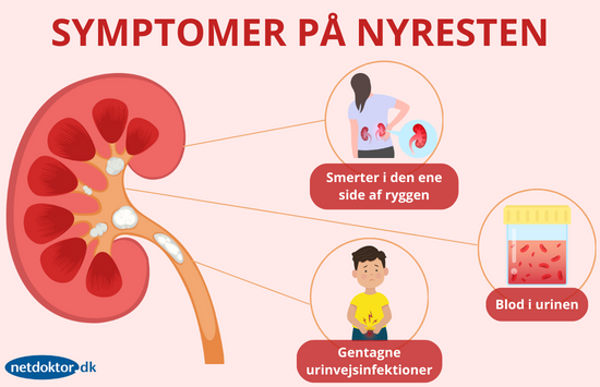 Symptomer pa nyresten